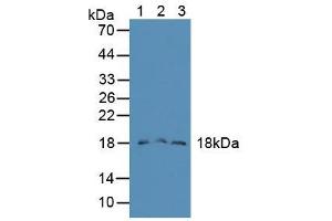 Western blot analysis of (1) Mouse Liver Tissue, (2) Mouse Lung Tissue and (3) Mouse Pancreas Tissue. (FAM19A2 Antikörper  (AA 31-119))