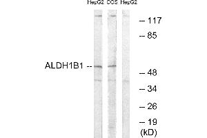 Western blot analysis of extracts from HepG2 cells and COS cells, using ALDH1B1 antibody. (ALDH1B1 Antikörper)