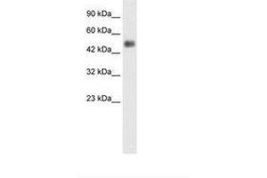 Image no. 3 for anti-Glial Cells Missing Homolog 1 (GCM1) (N-Term) antibody (ABIN6735857)