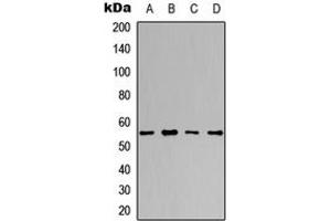 Western blot analysis of DNA Polymerase gamma 2 expression in A549 (A), HeLa (B), NS-1 (C), H9C2 (D) whole cell lysates. (POLG2 Antikörper  (Center))