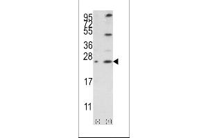 Western blot analysis of Bcl-w3 using rabbit polyclonal Bcl-w BH3 Domain Antibody using 293 cell lysates (2 ug/lane) either nontransfected (Lane 1) or transiently transfected with the BCL2L2 gene (Lane 2). (BCL2L2 Antikörper  (AA 24-59))