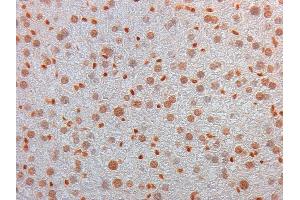 Immunohistochemistry of Mouse Monoclonal anti AKT3 Antibody in Mouse Embryonic Kidney Tissue: Mouse Liver Fixation: FFPE buffered formalin 10% conc Ag Retrieval: Heat, Citrate pH 6. (AKT3 Antikörper  (Internal Region))