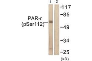 Western blot analysis of extracts from Jurkat cells treated with Paclitaxel 1uM 24h, using PPAR-gamma (Phospho-Ser112) Antibody. (PPARG Antikörper  (pSer112))