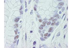 Immunohistochemistry (IHC) image for anti-Cyclin-Dependent Kinase 11B (CDK11B) (C-Term) antibody (ABIN7448470) (CDK11 Antikörper  (C-Term))