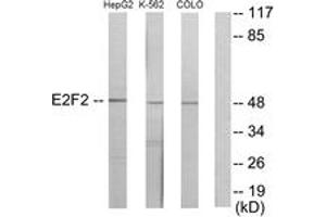 Western blot analysis of extracts from HepG2/K562/COLO205 cells, using E2F2 Antibody. (E2F2 Antikörper  (AA 221-270))