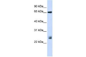 Western Blotting (WB) image for anti-Tripartite Motif Containing 8 (TRIM8) antibody (ABIN2458426) (TRIM8 Antikörper)