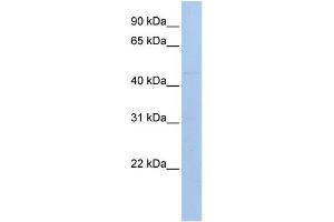 WB Suggested Anti-MAB21L1 Antibody Titration: 0.