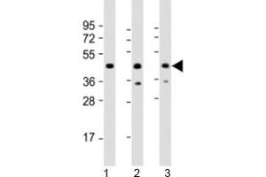 Western blot testing of human 1) 293T/17, 2) Jurkat and 3) K562 cell lysate with PHF6 antibody at 1:2000. (PHF6 Antikörper  (AA 148-180))