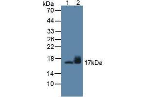 Figure. (SNCG Antikörper  (AA 1-123))