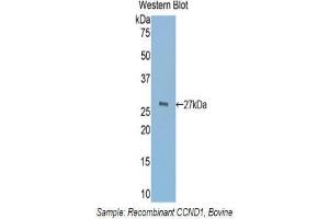 Western Blotting (WB) image for anti-Cyclin D1 (CCND1) (AA 72-272) antibody (ABIN3208329) (Cyclin D1 Antikörper  (AA 72-272))