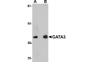 Western Blotting (WB) image for anti-GATA Binding Protein 3 (GATA3) (C-Term) antibody (ABIN1030408) (GATA3 Antikörper  (C-Term))