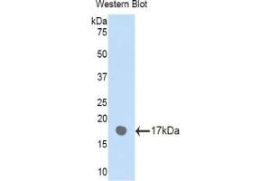 Detection of Recombinant PLXNB1, Human using Polyclonal Antibody to Plexin B1 (PLXNB1) (PLXNB1 Antikörper  (AA 47-126))