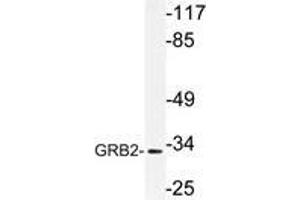 Western blot (WB) analysis of GRB2 antibody in extracts from Jurkat cells. (GRB2 Antikörper)
