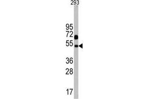 Western blot analysis of Nptx1 Antibody (C-term) in 293 cell line lysates (35 µg/lane). (NPX1 Antikörper  (C-Term))