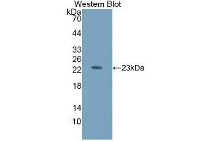 Detection of Recombinant HEXb, Human using Polyclonal Antibody to Hexosaminidase B Beta (HEXb) (HEXB Antikörper  (AA 122-311))