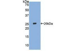 Western blot analysis of recombinant Human LOX1. (OLR1 Antikörper  (AA 81-273))