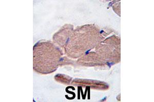 Formalin-fixed and paraffin-embedded human skeletal muscle tissue reacted with MSTN polyclonal antibody  , which was peroxidase-conjugated to the secondary antibody, followed by DAB staining. (MSTN Antikörper  (AA 17-46))