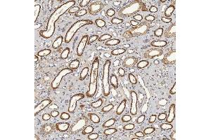 IHC analysis of SFXN5 using anti-SFXN5 antibody (ABIN7601388). (Sideroflexin 5 Antikörper  (AA 34-340))