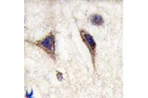 Image no. 2 for anti-Microtubule-Associated Protein tau (MAPT) antibody (ABIN356907) (MAPT Antikörper)