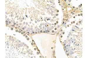 Phospho-SGK2 (Thr253) Antibody at 1/100 staining Rat testis tissue by IHC-P.