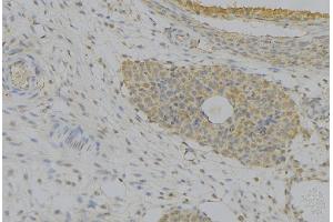 ABIN6277388 at 1/100 staining Human uterus tissue by IHC-P. (IGFBP7 Antikörper  (Internal Region))