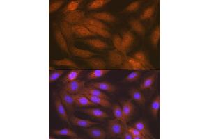 Immunofluorescence analysis of C6 cells using RAIDD/CRADD Rabbit mAb (ABIN7266106) at dilution of 1:100 (40x lens). (CRADD Antikörper)