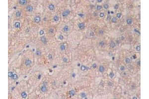 DAB staining on IHC-P; Samples: Human Liver Tissue. (CYFRA21.1 Antikörper  (AA 244-400))