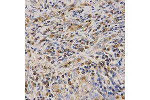 Immunohistochemistry (IHC) image for anti-Cathelicidin Antimicrobial Peptide (CAMP) (AA 31-170) antibody (ABIN6218724) (Cathelicidin Antikörper  (AA 31-170))