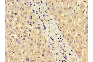 Immunohistochemistry of paraffin-embedded human liver tissue using ABIN7144599 at dilution of 1:100 (ASS1 Antikörper  (AA 168-222))