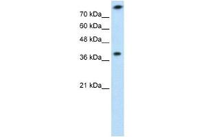 TST antibody used at 1 ug/ml to detect target protein. (TST Antikörper)