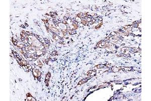 IHC analysis of ORP150/HYOU1 using anti-ORP150/HYOU1 antibody (ABIN7601807).