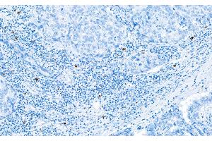 Immunohistochemistry (IHC) image for anti-Granzyme B (GZMB) (AA 19-247) antibody (ABIN7449554) (Rekombinanter GZMB Antikörper  (AA 19-247))