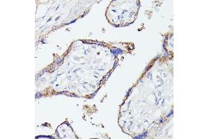 Immunohistochemistry of paraffin-embedded human placenta using LTF antibody (ABIN6131498, ABIN6143382, ABIN6143383 and ABIN6216705) at dilution of 1:100 (40x lens). (Lactoferrin Antikörper  (AA 500-710))