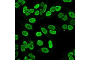 Immunofluorescence Analysis of PFA fixed HeLa cells labeling Cyclin B1 MAb (SPM619)followed by Goat anti-mouse IgG-CF488 (Green). (Cyclin B1 Antikörper)