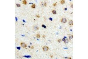 Immunohistochemical analysis of ICK staining in human brain formalin fixed paraffin embedded tissue section. (ICK Antikörper)