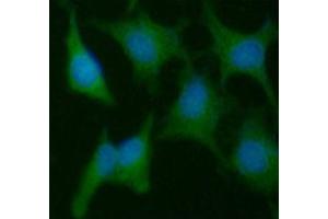 ICC/IF analysis of PPIC in HeLa cells line, stained with DAPI (Blue) for nucleus staining and monoclonal anti-human PPIC antibody (1:100) with goat anti-mouse IgG-Alexa fluor 488 conjugate (Green).