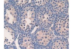 Immunohistochemistry (IHC) image for anti-Secretory Leukocyte Peptidase Inhibitor (SLPI) (AA 20-131) antibody (ABIN7433429)