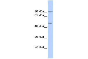 WB Suggested Anti-KCNJ8 Antibody Titration: 0. (KCNJ8 Antikörper  (Middle Region))