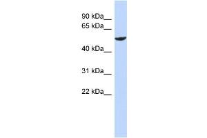 WB Suggested Anti-ZNF154 Antibody Titration:  0. (ZNF154 Antikörper  (N-Term))