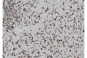 ABIN6278246 at 1/100 staining Human gastric tissue by IHC-P. (Dual Specificity Phosphatase 3 (DUSP3) (N-Term) Antikörper)