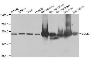 Western blot analysis of extracts of various cell lines, using GLUD1 antibody. (GLUD1 Antikörper  (AA 54-240))