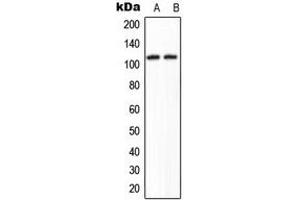 Western blot analysis of KIAA1967 expression in A549 (A), HeLa (B) whole cell lysates.