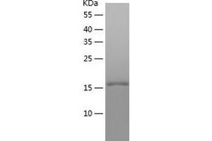 ENTPD4 Protein (AA 374-551) (His tag)