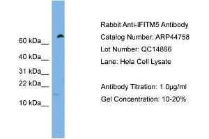 WB Suggested Anti-IFITM5  Antibody Titration: 0.