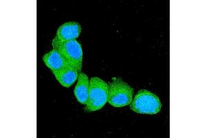 IF analysis of S100A4 using anti-S100A4 antibody (ABIN7600462). (s100a4 Antikörper  (AA 2-101))