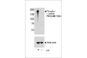 Western blot analysis of lysate from A431 cell line, using Phospho-HUN-PIK3C2B (ABIN6241073 and ABIN6578945). (PIK3C2B Antikörper  (pTyr228))