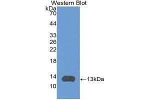 Western blot analysis of the recombinant protein. (CXCL11 Antikörper  (AA 22-100))