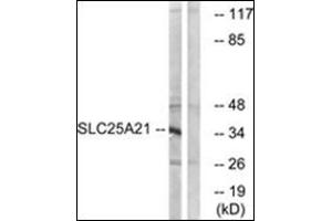 Western blot analysis of extracts from HepG2 cells, using SLC25A21 Antibody   The lane on the right is treated with the synthesized peptide. (SLC25A21 Antikörper  (Internal Region))