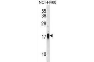 Western Blotting (WB) image for anti-CD70 Molecule (CD70) antibody (ABIN2998201) (CD70 Antikörper)