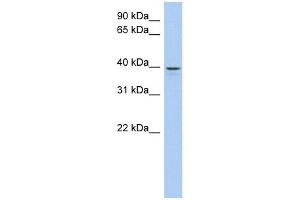 LIX1L antibody used at 1 ug/ml to detect target protein. (LIX1L Antikörper)
